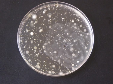 Obr. 2. Ukázka kultivovaných bakterií