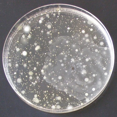 Obr. č. 5b. – Ukázka již kultivovaných vzorků na Petriho miskách: bakterie