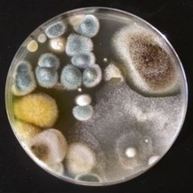 Obr. 2a – Příklad organické kontaminace vzduchu koloniemi bakterií a plísní